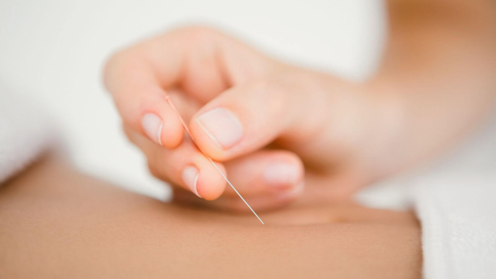 Fertility Acupuncture 101: How Does Acupuncture Work?